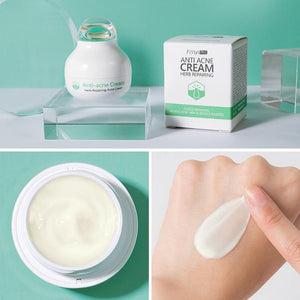 Acne Face Cream Treatment - Image #4
